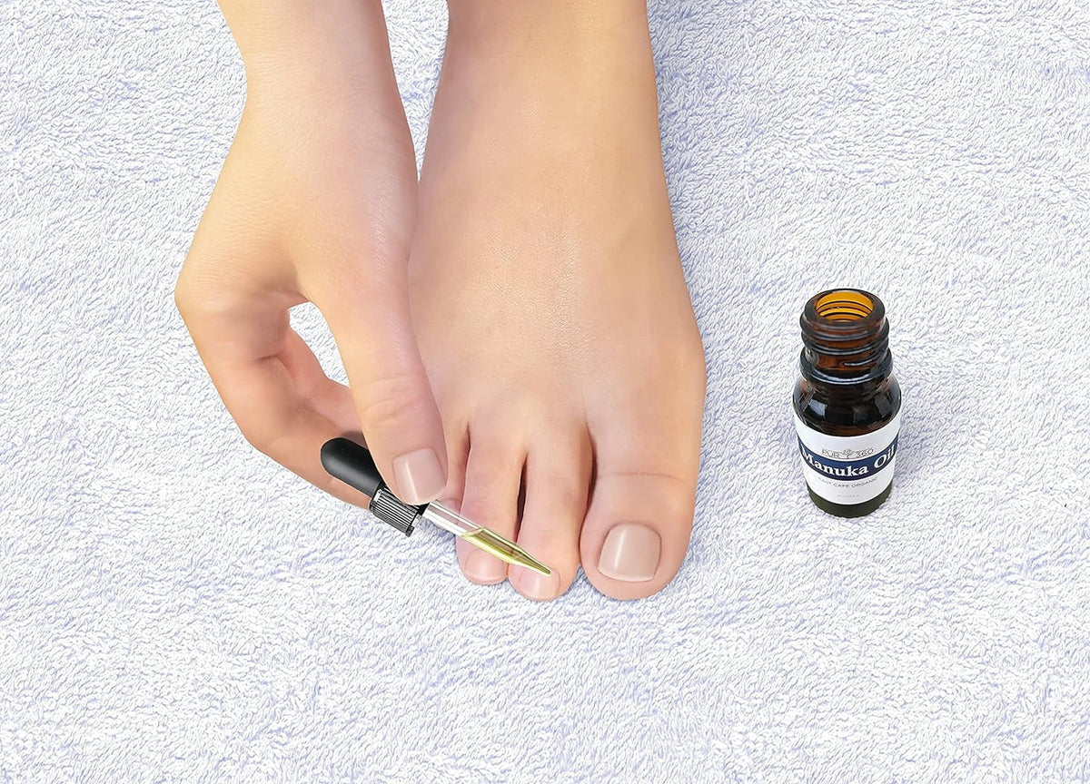 pur360 treatment manuka oil, pure powerful fungus, than cold sores, acne, best organic, oil, more tree for tea 33x irritated and skin eczema, fungus, toenail foot natural